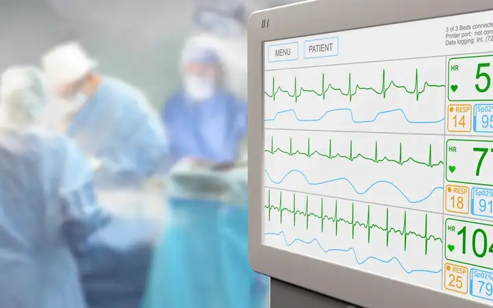 Display showing a patient's vital signs in a hospital operating theatre