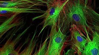 Fibroblasts labeled with fluorescent dyes