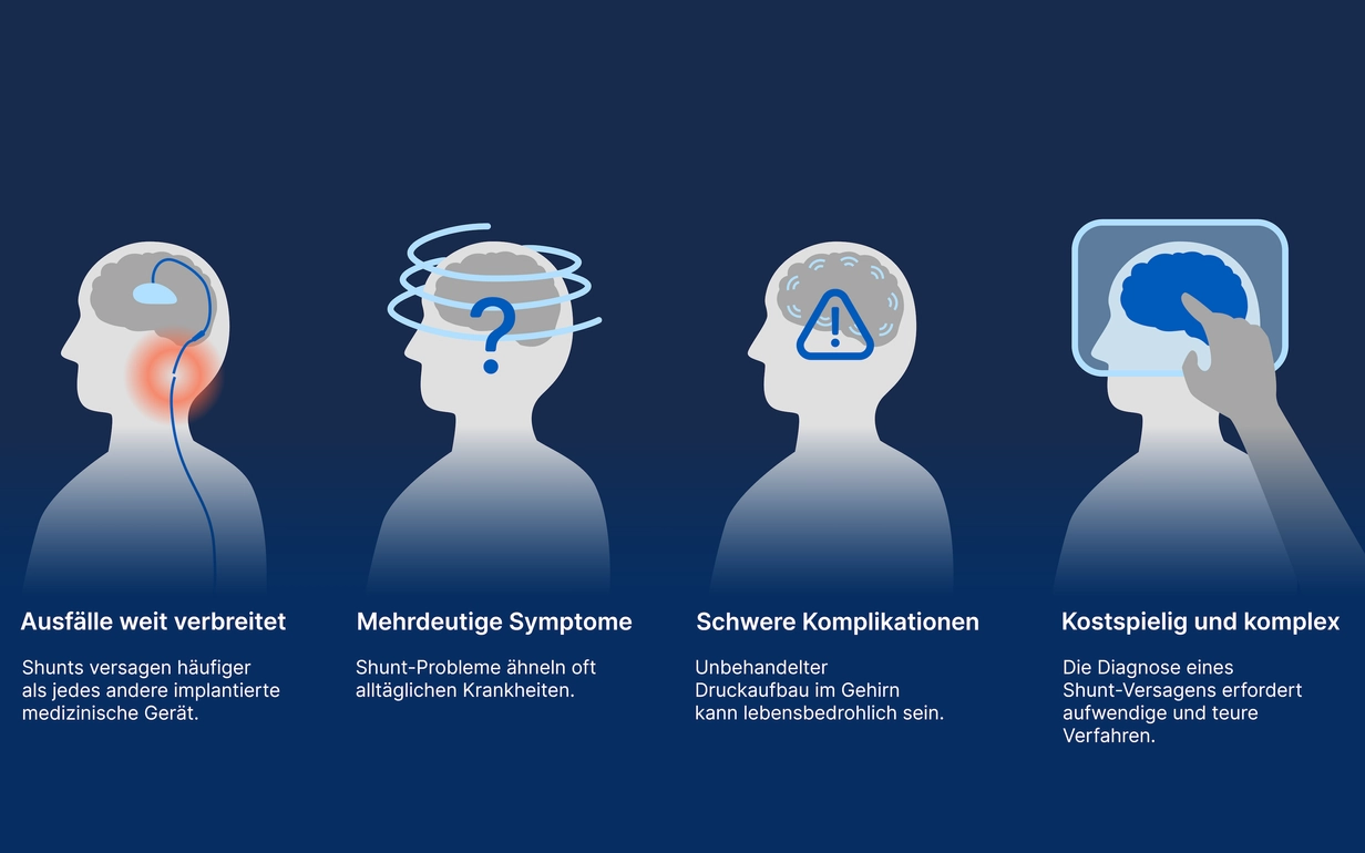 Eine Infografik über die Symptome und Risiken eines Shuntversagens
