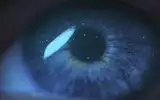 human eye