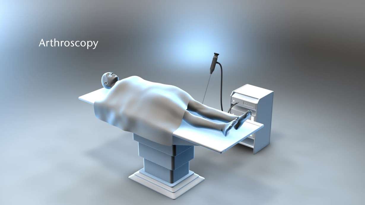 Arthroscopy system illustrating the integration of optical glass components