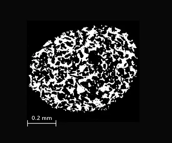 CoralPor® 大孔