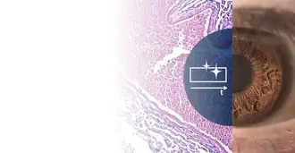 Image of an eye alongside microscopic view of tissue sample with graph icon