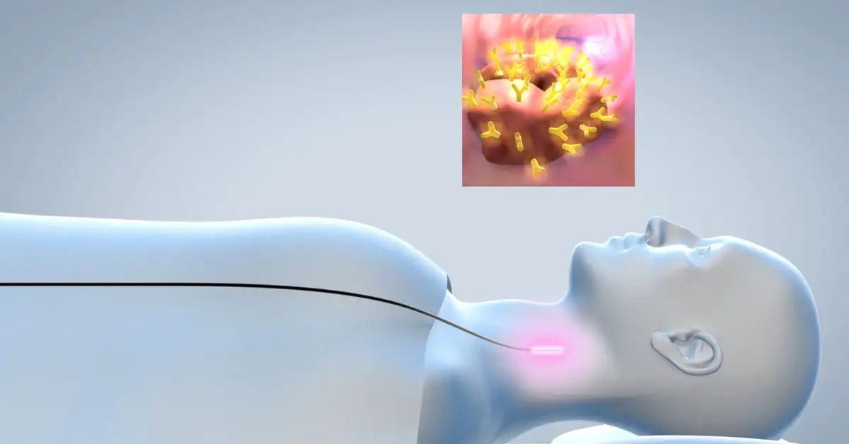 SCHOTT® Luminous Laser Diffusers
