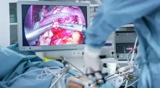 Surgeon looking at a monitor during operation