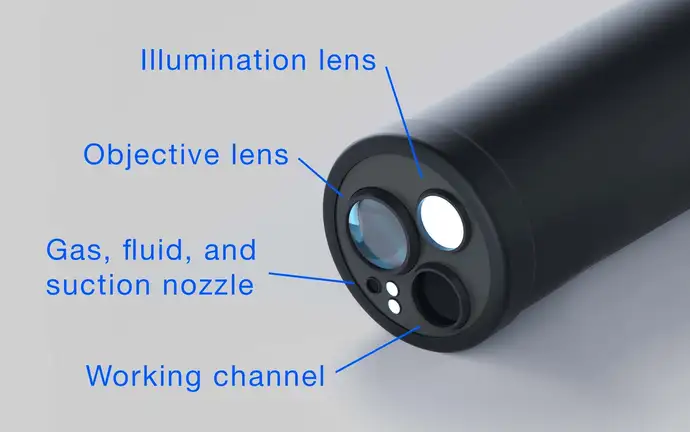 View of an endoscope tip