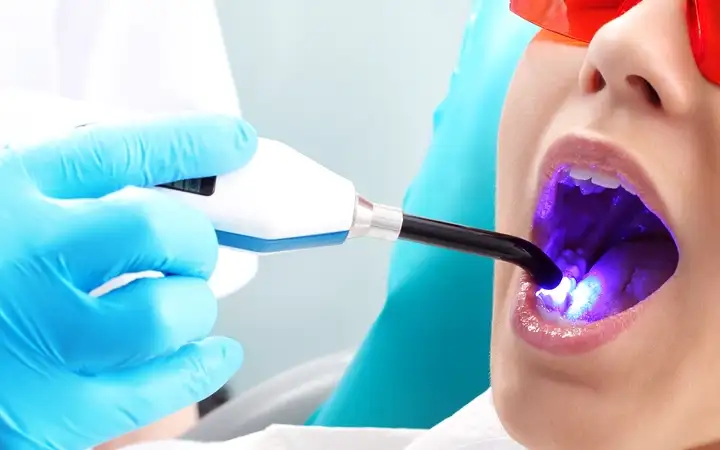 Dentist shining a SCHOTT light guide into a patient's mouth