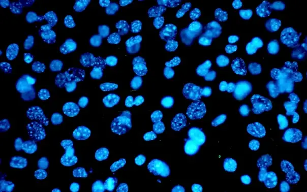 Fluorescent cells under microscope