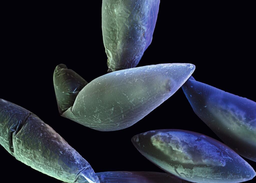 Rasterelektronenmikroskopische Aufnahme von biolumineszierender Algen