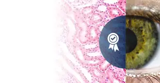 Image of an eye alongside microscopic view of tissue sample with rosette icon