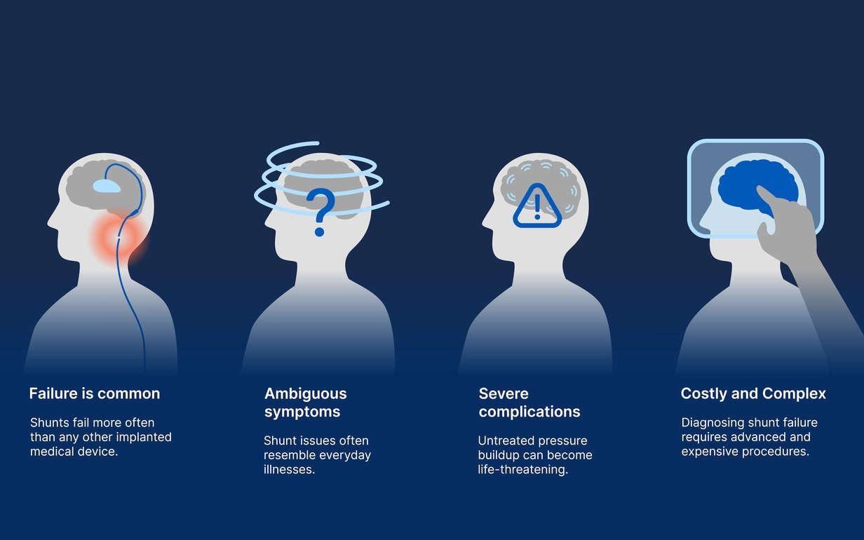 An infograhic depicting the symptoms and risks of shunt failure