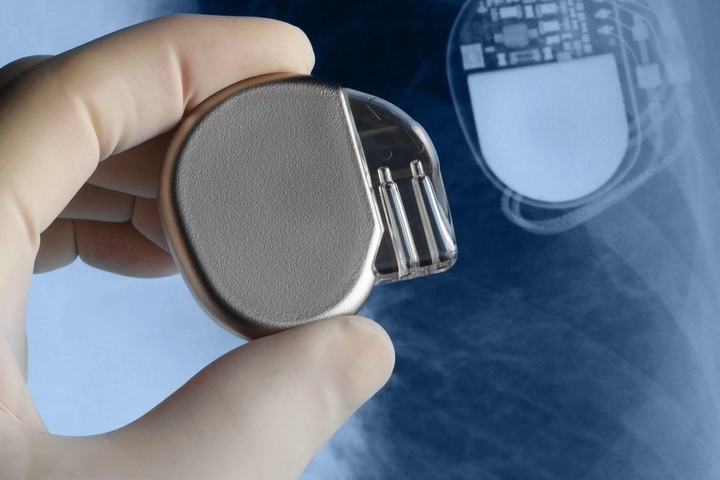 Hand holding a medical implant in front of an x-ray image